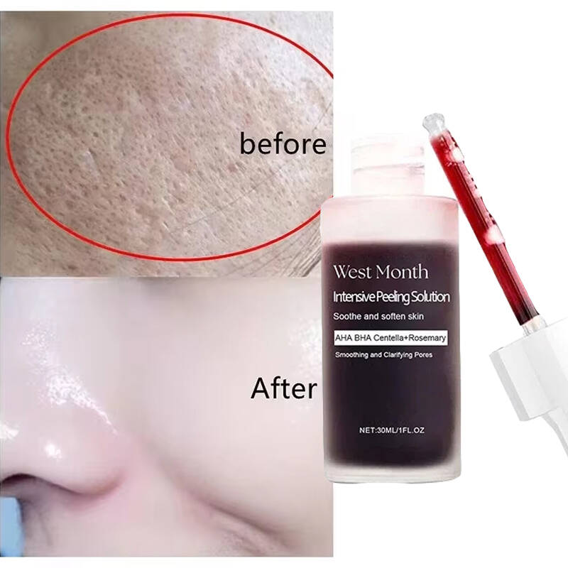 Tranexamic Acid Serum - İpek gibi hissettiriyor, filtre gibi görünüyor.