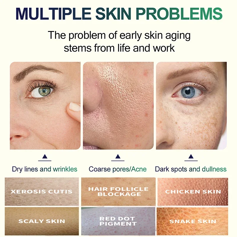 2. Nesil Salisilik Asit Yüz Pe - Tranexamic Acid Serum incelemesi ve fiyatı