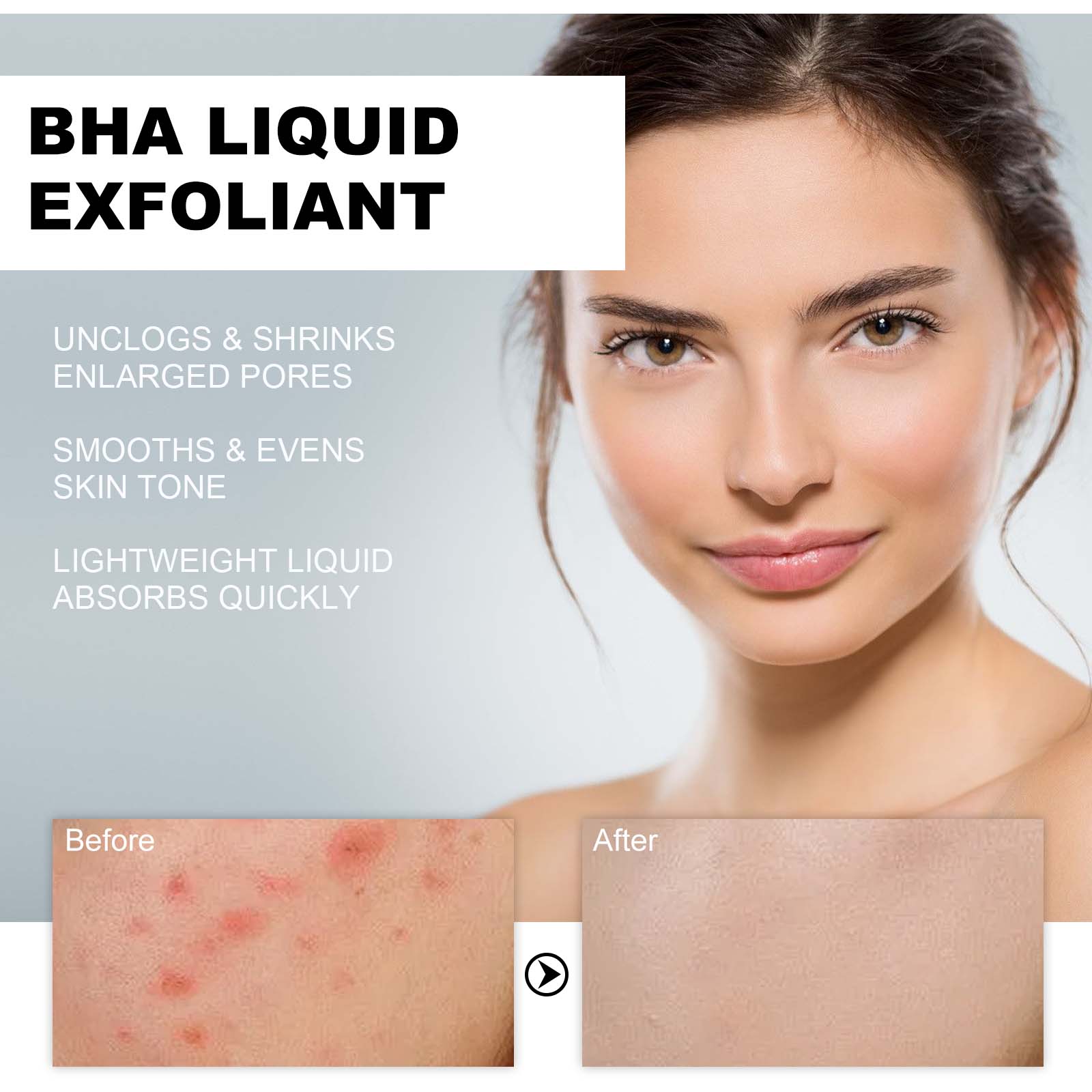 %2 Salisilik Asit Sıvı Eksfoli - Tranexamic Acid Serum incelemesi ve fiyatı