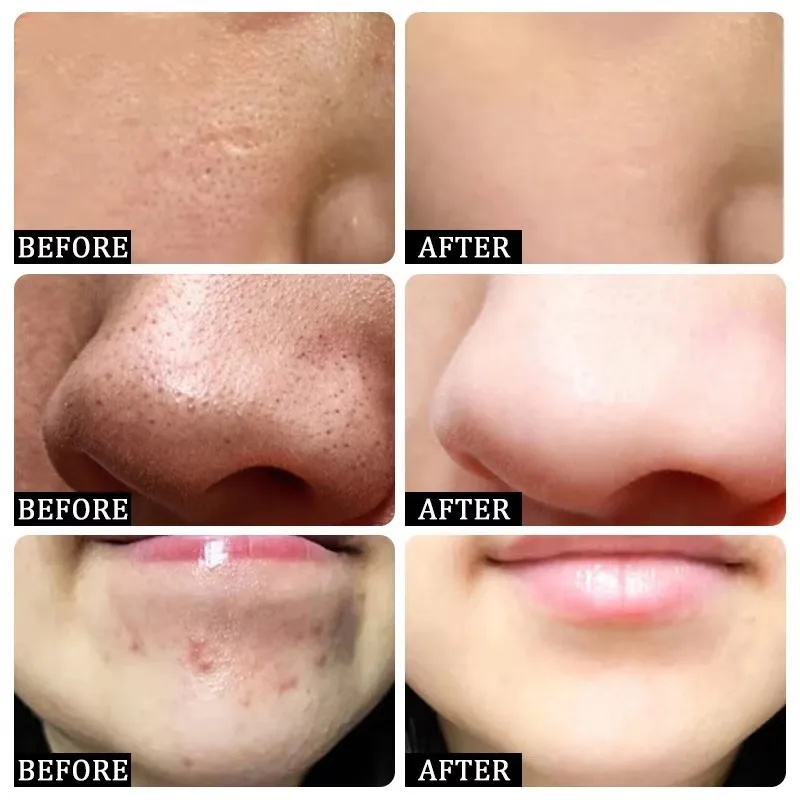 İpek gibi hissettiriyor, filtr - Tranexamic Acid Serum incelemesi ve fiyatı