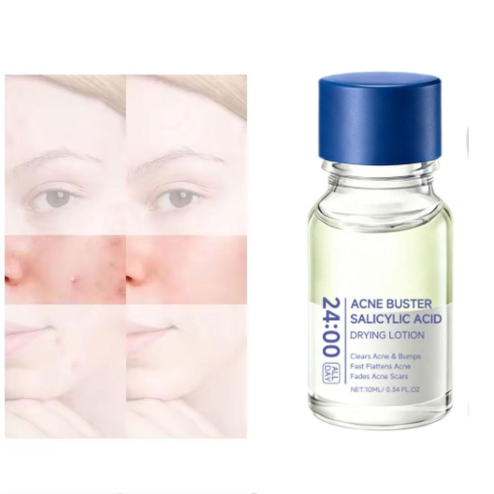 Salisilik Asit Özlü Bakım Losy - Tranexamic Acid Serum incelemesi ve fiyatı