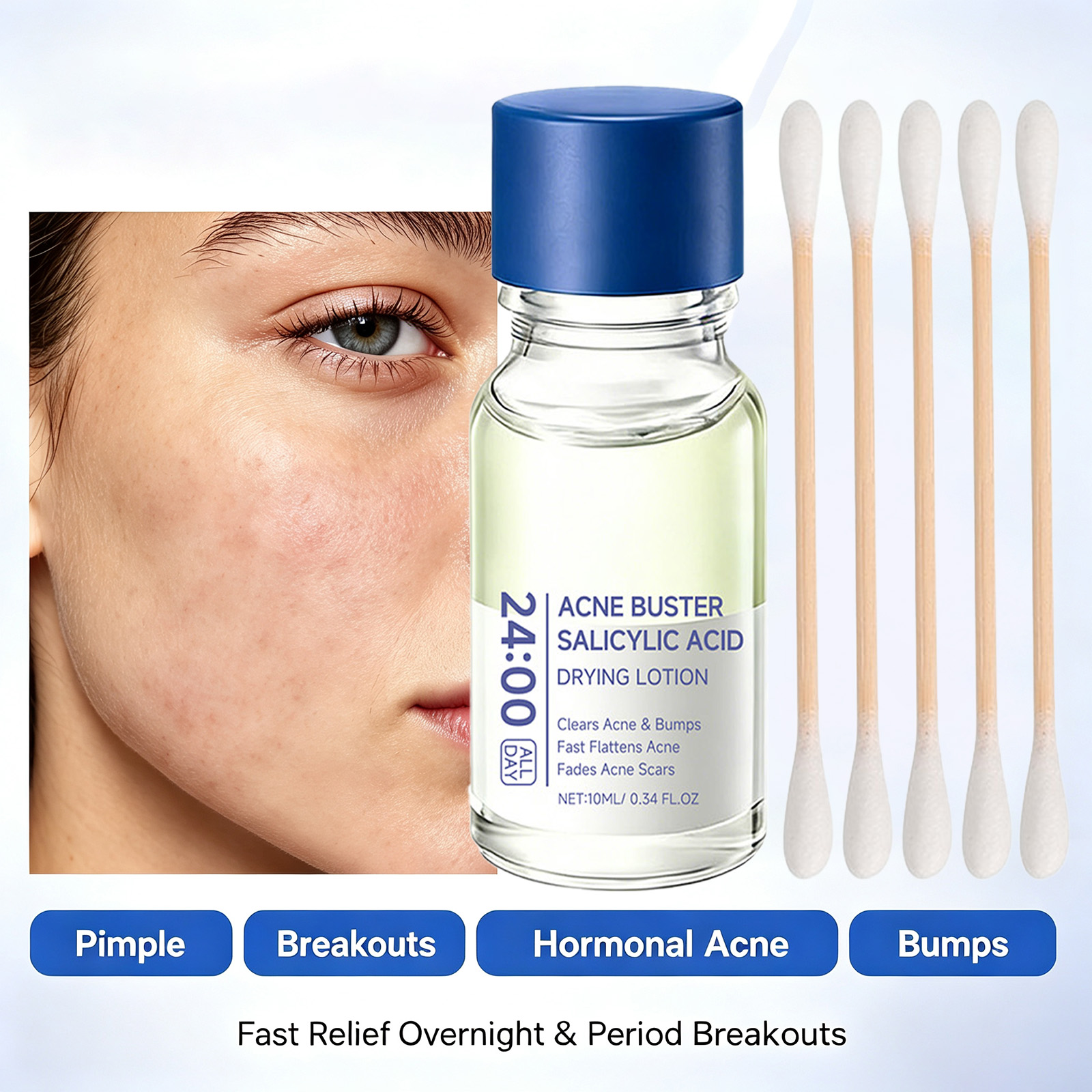 Salisilik Asit Sivilce Tedavi  - Tranexamic Acid Serum incelemesi ve fiyatı
