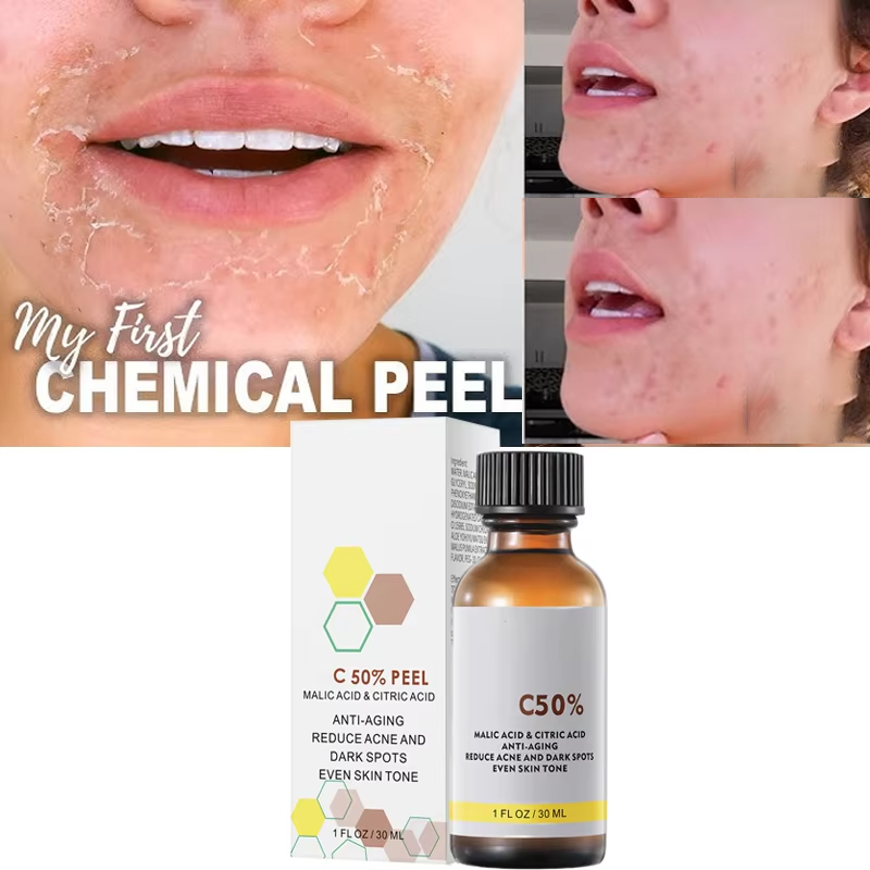 Yüz Yüz Peelingi İçin Malik As - Licorice Root Extract incelemesi ve fiyatı