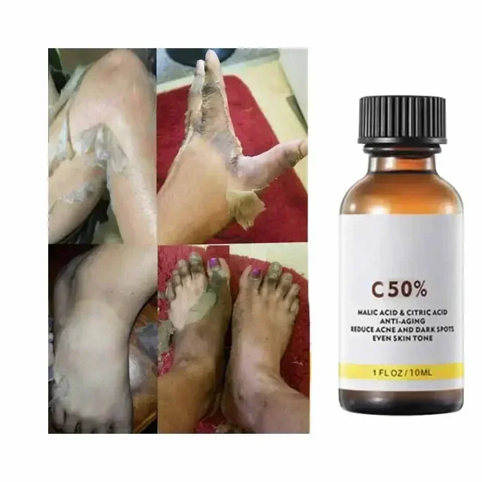 Yüz Yüz Peelingi İçin Malik As - Licorice Root Extract incelemesi ve fiyatı